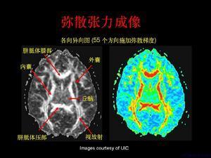 夜视仪成像清晰还是可见光成像清晰